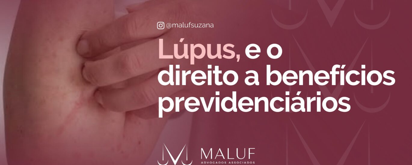 Lúpus, e o direito a benefícios previdenciários